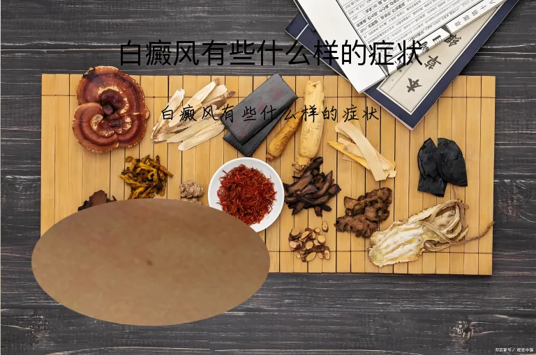 白癜风有些什么样的症状
