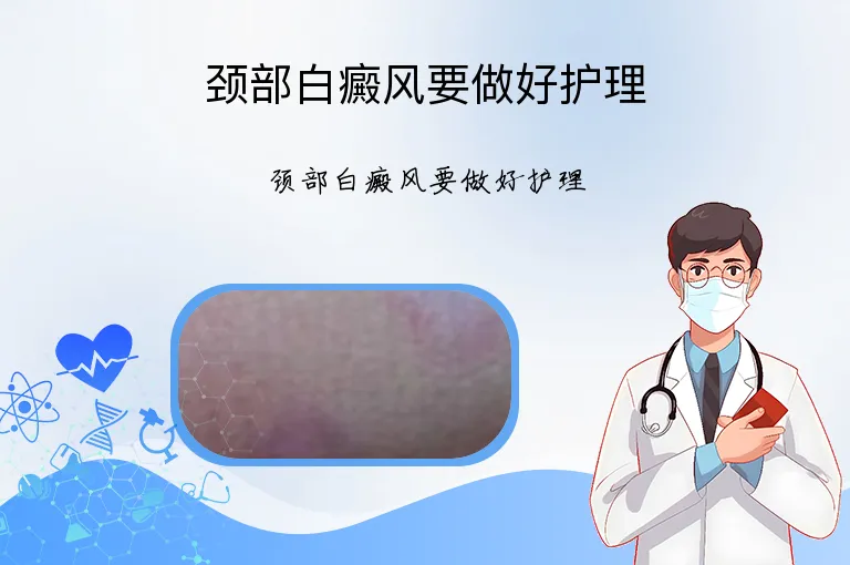 颈部白癜风要做好护理