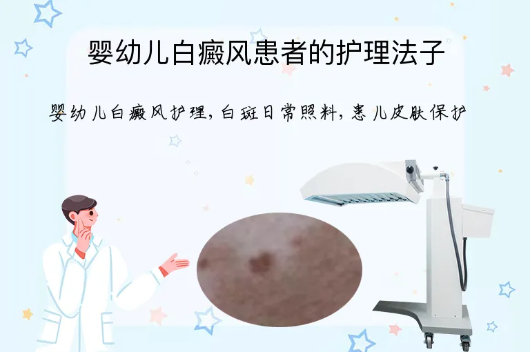 婴幼儿白癜风患者的护理法子