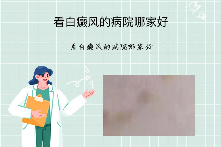 看白癜风的病院哪家好