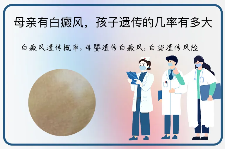 母亲有白癜风，孩子遗传的几率有多大
