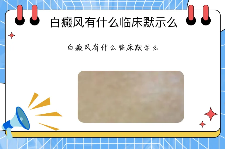 白癜风有什么临床默示么
