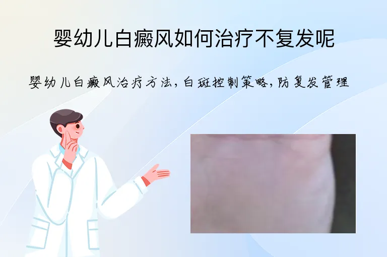 婴幼儿白癜风如何治疗不复发呢
