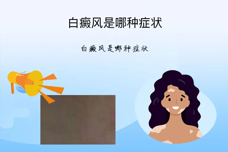白癜风是哪种症状