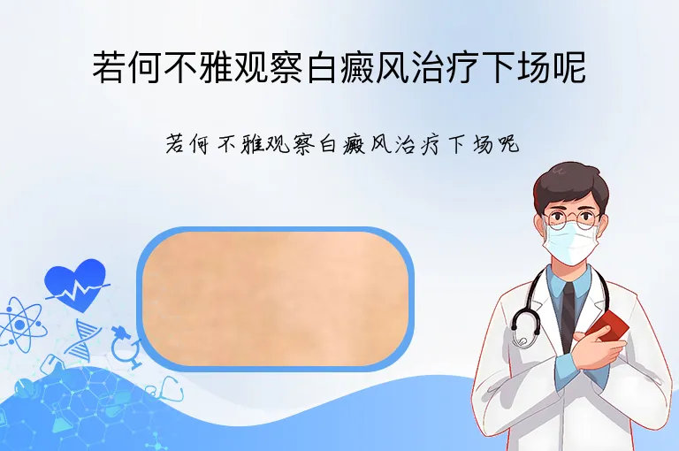 若何不雅观察白癜风治疗下场呢