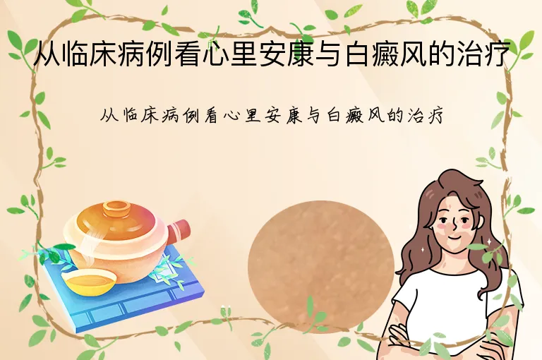 从临床病例看心里安康与白癜风的治疗