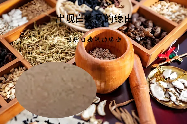 出现白癜风的缘由