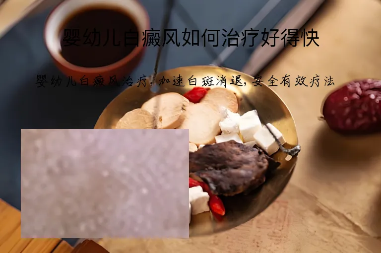 婴幼儿白癜风如何治疗好得快