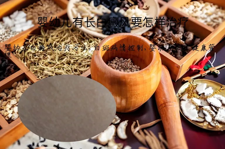 婴幼儿有长白癜风要怎样治疗