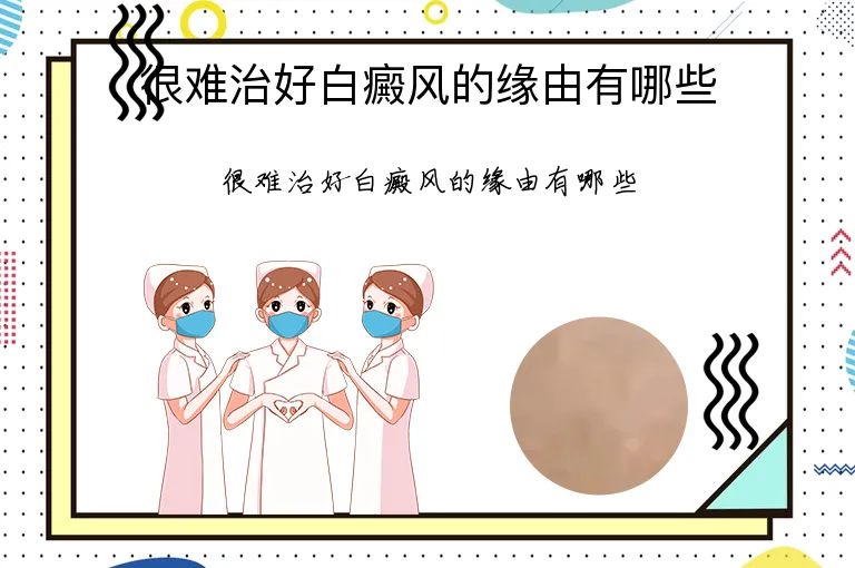 很难治好白癜风的缘由有哪些