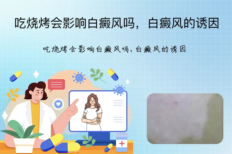 吃烧烤会影响白癜风吗，白癜风的诱因