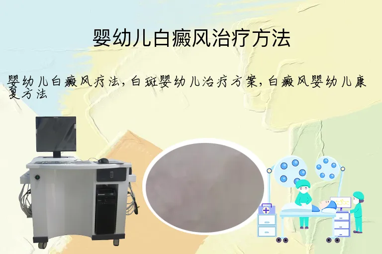 婴幼儿白癜风治疗方法