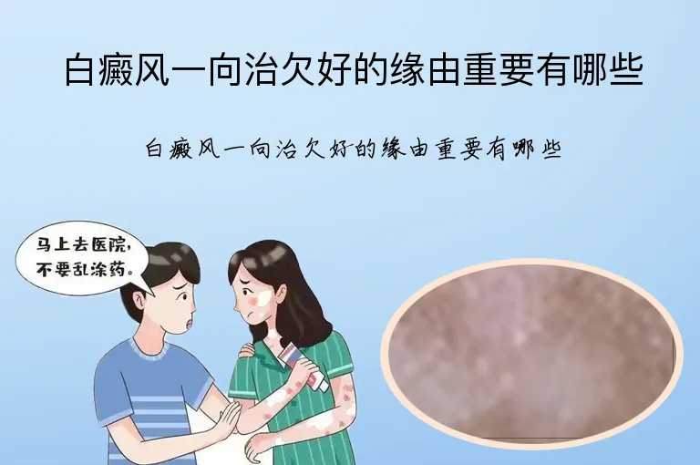 白癜风一向治欠好的缘由重要有哪些