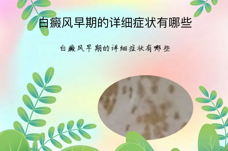 白癜风早期的详细症状有哪些