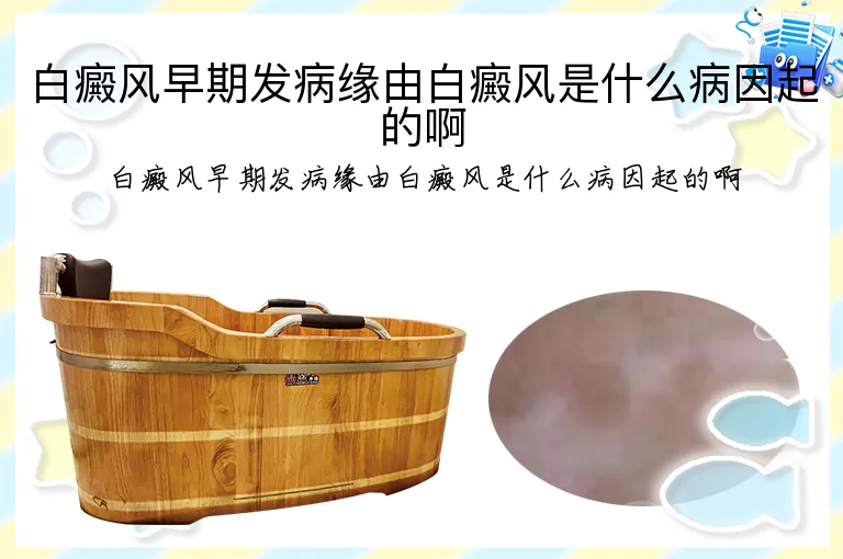 白癜风早期发病缘由白癜风是什么病因起的啊