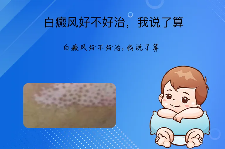 白癜风好不好治，我说了算