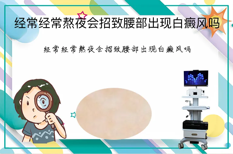 经常经常熬夜会招致腰部出现白癜风吗