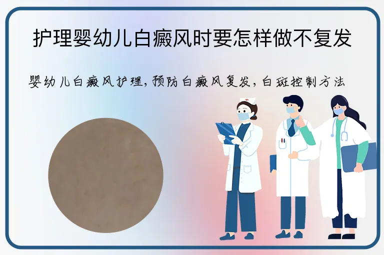 护理婴幼儿白癜风时要怎样做不复发