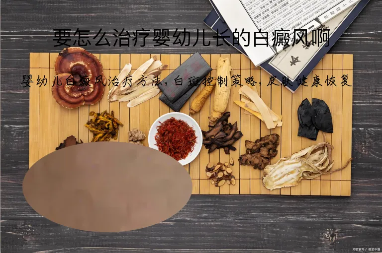 要怎么治疗婴幼儿长的白癜风啊