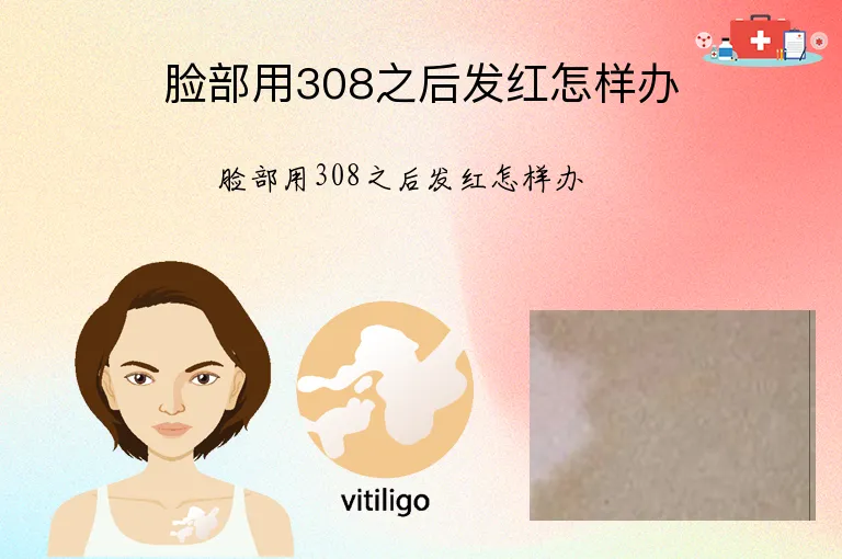 脸部用308之后发红怎样办