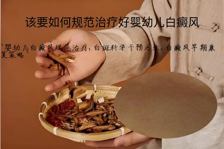 该要如何规范治疗好婴幼儿白癜风