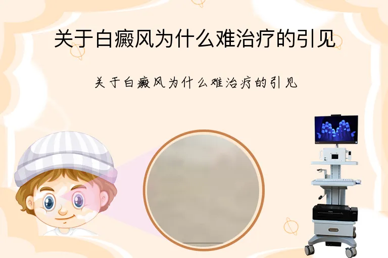 关于白癜风为什么难治疗的引见