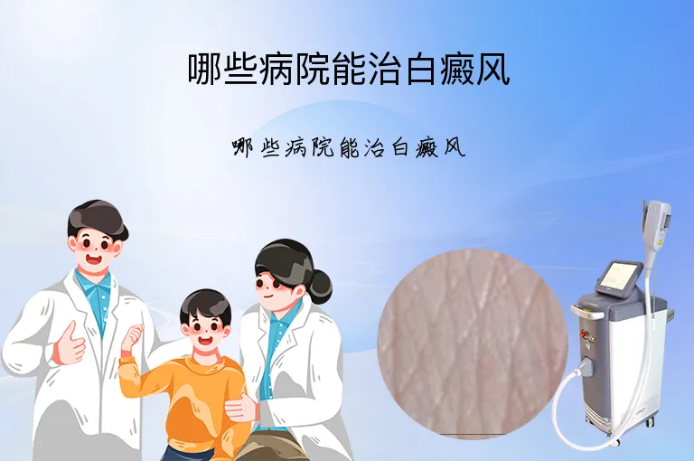 哪些病院能治白癜风