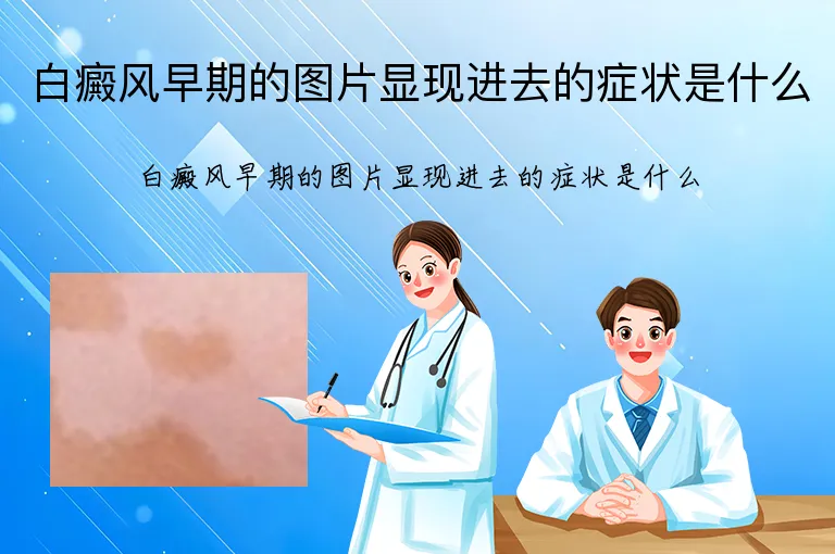 白癜风早期的图片显现进去的症状是什么