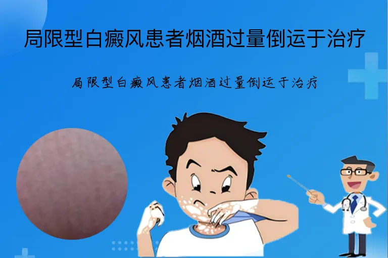 局限型白癜风患者烟酒过量倒运于治疗