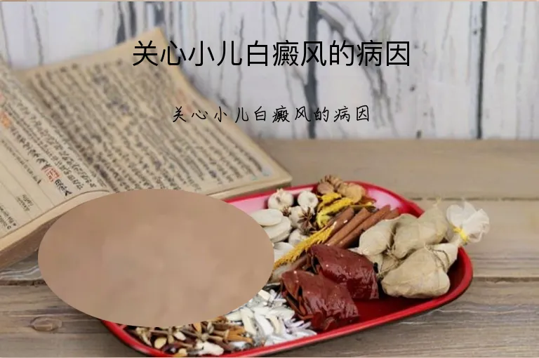 关心小儿白癜风的病因