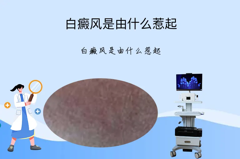 白癜风是由什么惹起