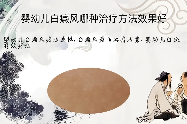婴幼儿白癜风哪种治疗方法效果好