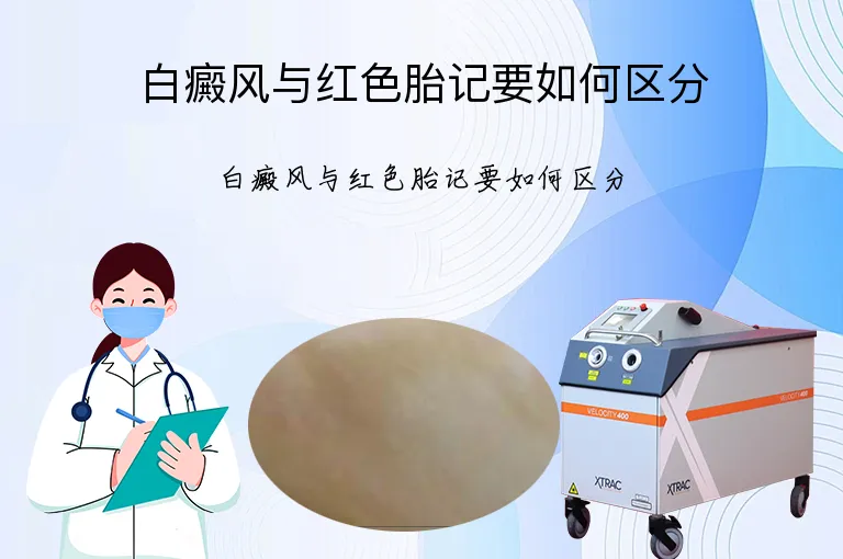 白癜风与红色胎记要如何区分