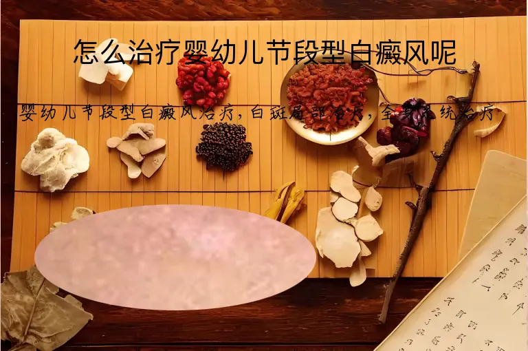 怎么治疗婴幼儿节段型白癜风呢
