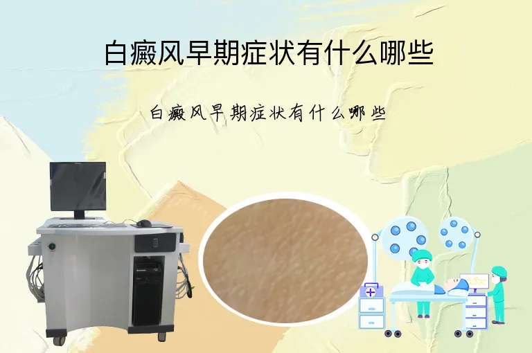 白癜风早期症状有什么哪些
