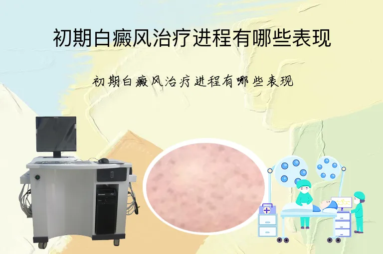初期白癜风治疗进程有哪些表现