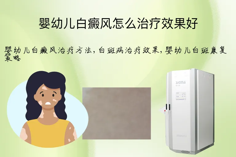 婴幼儿白癜风怎么治疗效果好