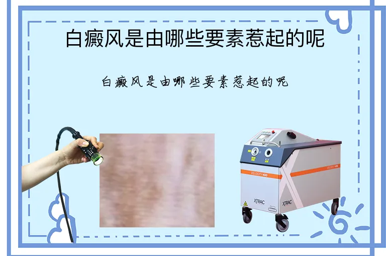 白癜风是由哪些要素惹起的呢