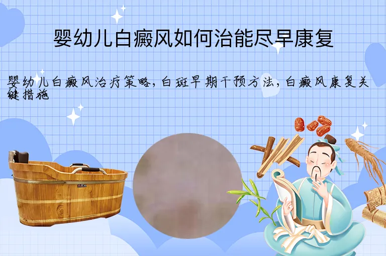 婴幼儿白癜风如何治能尽早康复