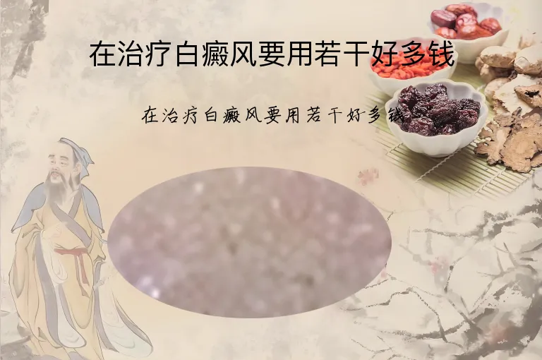 在治疗白癜风要用若干好多钱