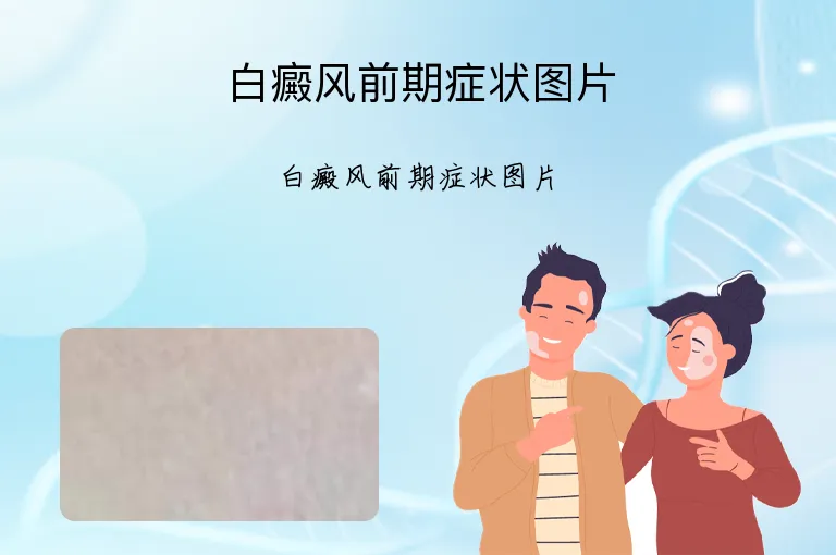 白癜风前期症状图片