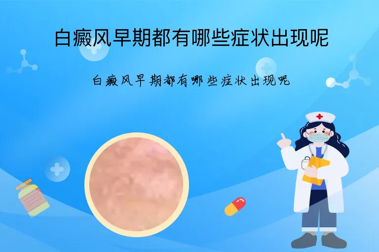 白癜风早期都有哪些症状出现呢