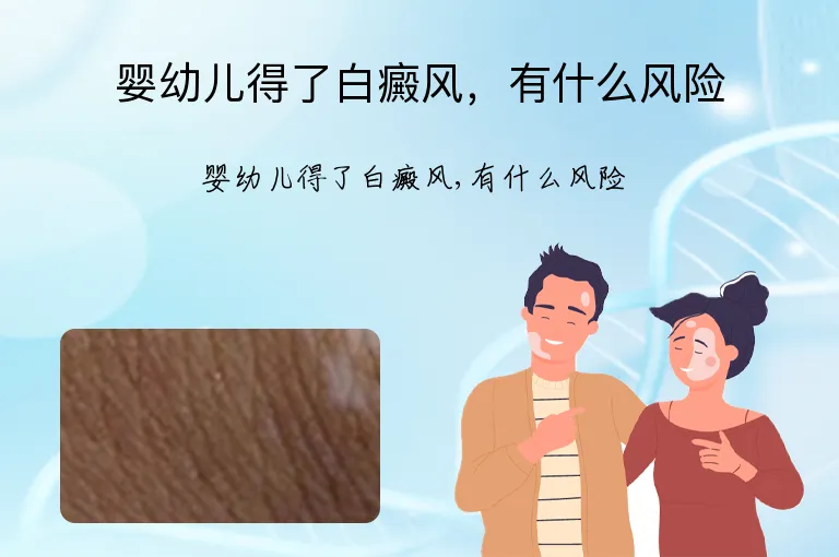 婴幼儿得了白癜风，有什么风险