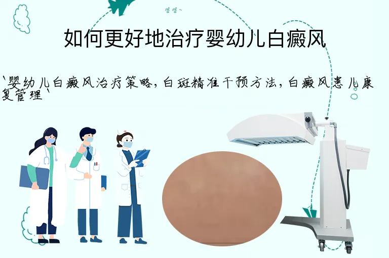 如何更好地治疗婴幼儿白癜风