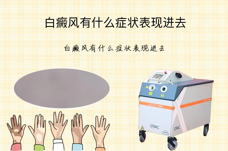 白癜风有什么症状表现进去