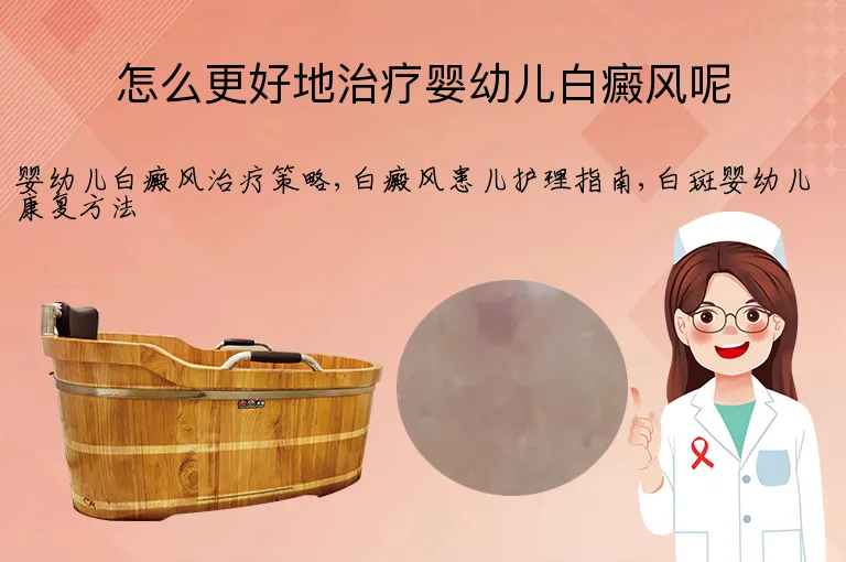 怎么更好地治疗婴幼儿白癜风呢