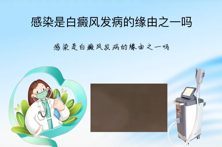 感染是白癜风发病的缘由之一吗
