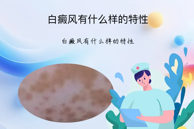 白癜风有什么样的特性
