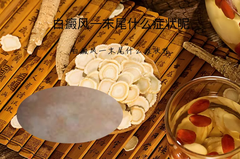 白癜风一末尾什么症状呢
