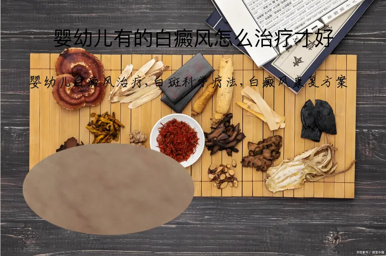 婴幼儿有的白癜风怎么治疗才好
